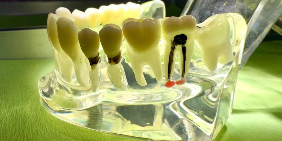 Endodoncia 